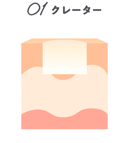 01クレーター