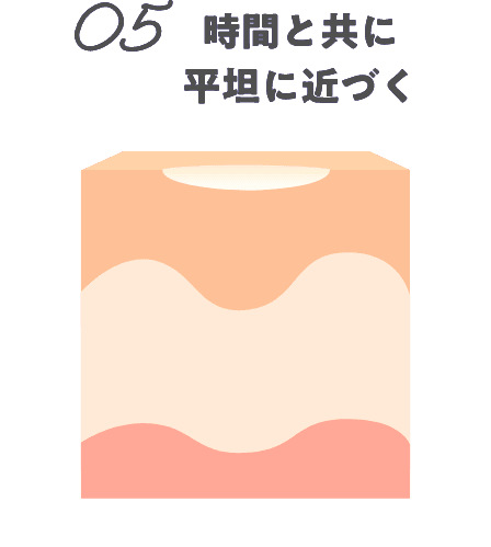 05時間と共に平坦に近づく