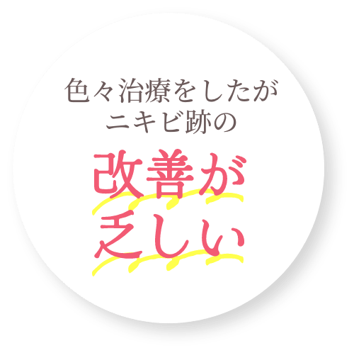 色々治療をしたがニキビ跡の改善が乏しい