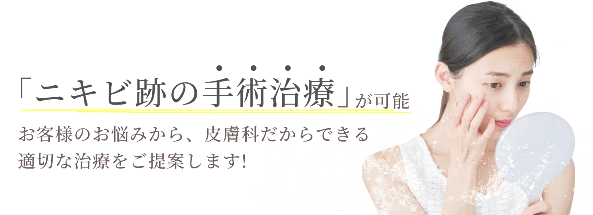 「ニキビ跡の手術治療」が可能。お客様のお悩みから、皮膚科だからできる適切な治療をご提案します!