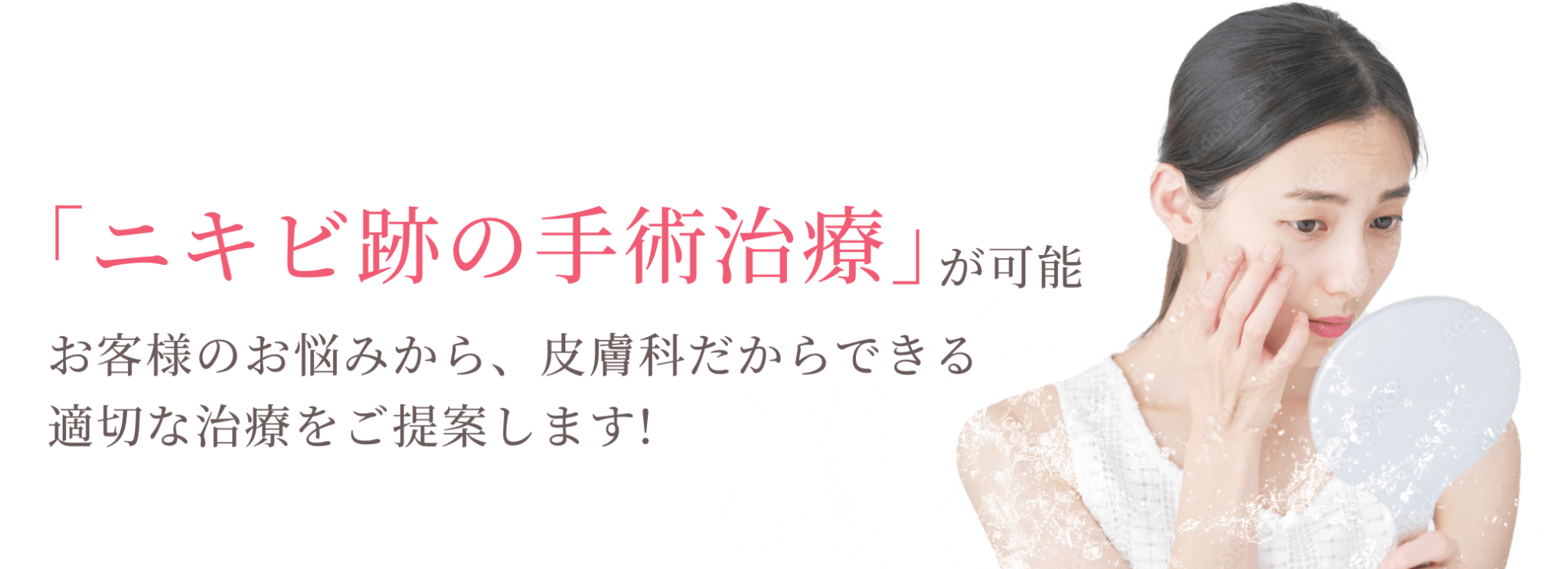 「ニキビ跡の手術治療」が可能。お客様のお悩みから、皮膚科だからできる適切な治療をご提案します!