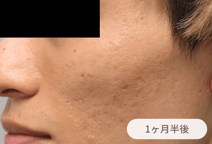 1ヶ月半後